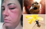 Che cosa succede se un'ape ha morso negli occhi e si è gonfiata