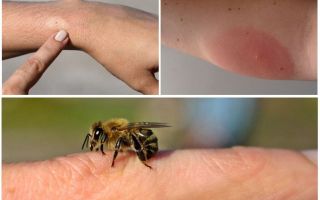 Reazione allergica alla puntura d'ape, cosa fare